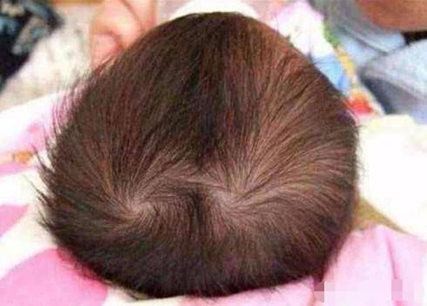 孩子头上有几个“头旋”，和孩子性格有关吗？看完你就知道了！