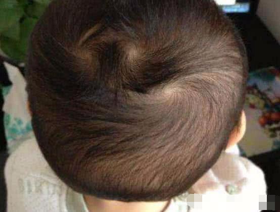 孩子头上有几个“头旋”，和孩子性格有关吗？看完你就知道了！