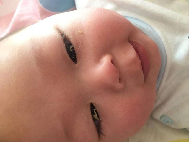 除了饮食，新生儿护理这3方面也不要忽略了！