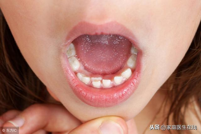 儿童牙齿没护理好，容易出现牙齿畸形！三招让孩子长出一口好牙