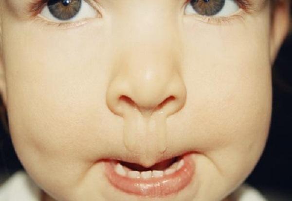 白色黄色绿色……医生：孩子鼻涕颜色不同，提示不同的健康状态