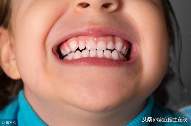 儿童牙齿没护理好，容易出现牙齿畸形！三招让孩子长出一口好牙