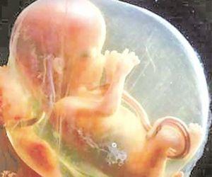 羊水浑浊是怎么回事？你懂吗？