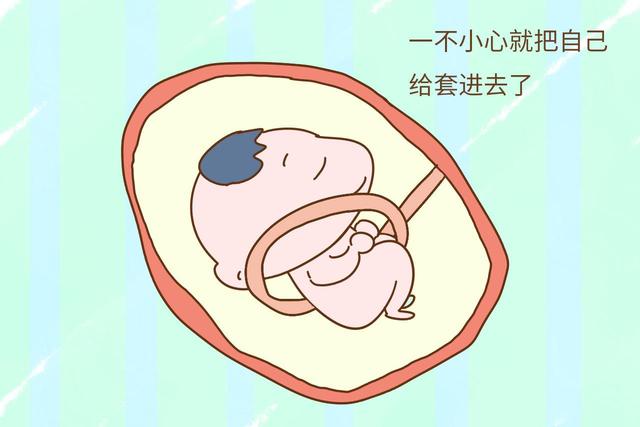 孕妈别慌，胎儿发生脐带绕颈后这样处理！