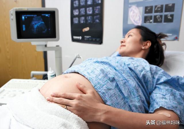 羊水穿刺到底做不做？这5种情况下，为了宝宝健康孕妈勇敢一次吧