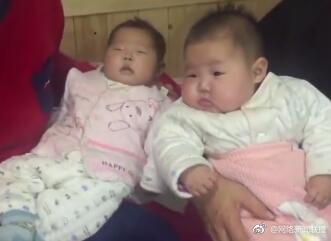 双胞胎妹妹出生76天竟做两次手术，体重仅有姐姐的一半