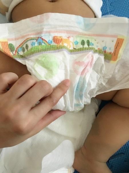 这样帮宝宝换尿不湿，告别漏尿漏屎、红痕！