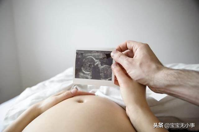 有这4个特征的孕妇，顺产的风险较高，剖腹产更安全