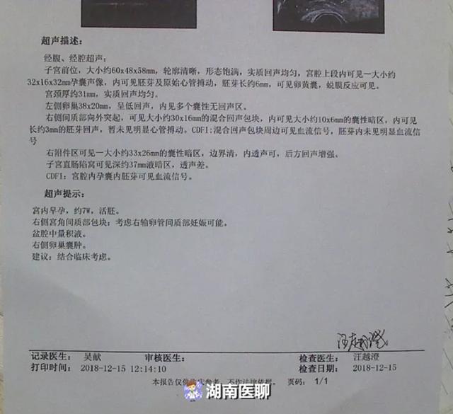 女子怀上“异地”双胞胎，一个在宫内一个在宫外？凶险！