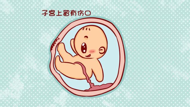 胎儿竟然踢破子宫？原来是瘢痕子宫惹得祸！