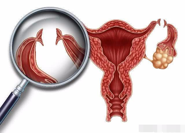 若女人不想怀孕，这4个“方法”能帮到你，第3个最好操作！
