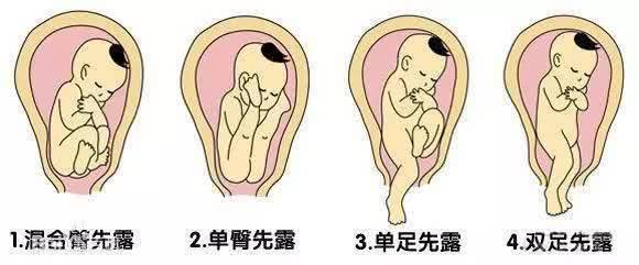 怀孕生子时,宝宝出现这些情况非常危险!