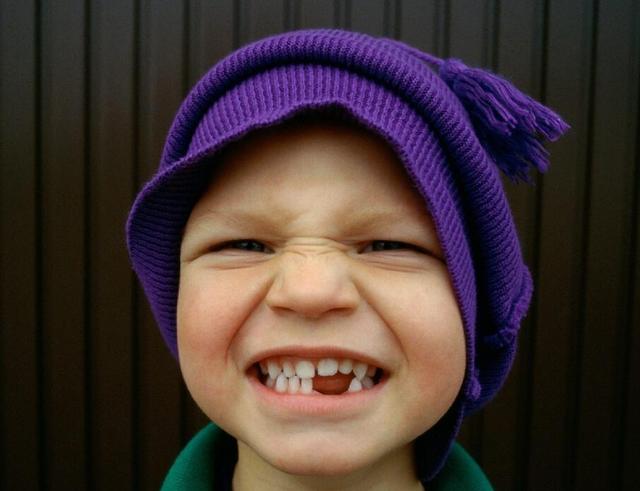 宝宝牙齿畸形还出现双排牙,医生说少吃了一样食物,对幼儿很关键