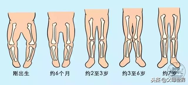 X型、O型腿怎么办？关于腿型的7个谣言，第1条就有人中招！