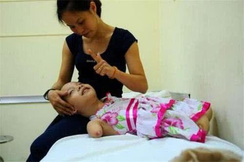 怀孕7个月查出胎儿没有手脚，孕妈不忍放弃，如今孩子被宠成公主