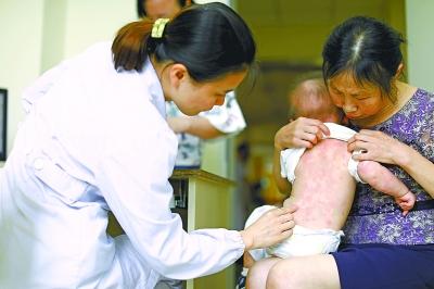 煮蛋酒没洗锅就煮稀饭 致7月大女婴严重过敏