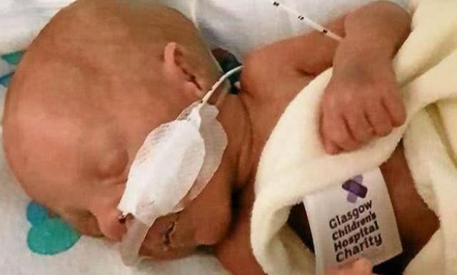 早产同卵三胞胎体最小的不足1斤，如今1岁多呆萌可爱