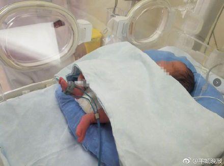 妈妈，请醒来看我一眼 孕妇遭车祸昏迷49天，宝宝顽强生长顺利出生！