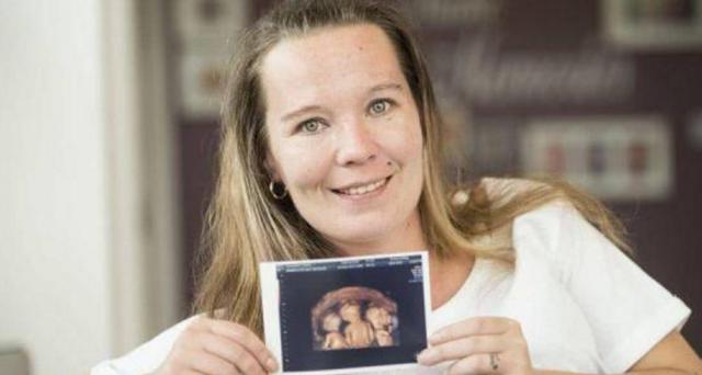 早产同卵三胞胎体最小的不足1斤，如今1岁多呆萌可爱