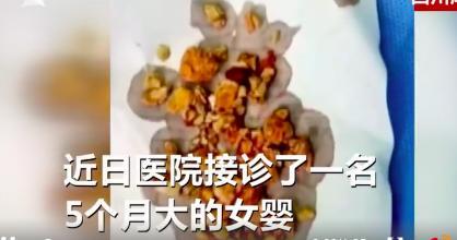 5个月宝宝双肾长满结石！医生下病重通知，只因家长做错这件事