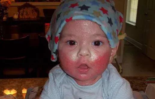 它是宝宝皮肤的“破坏之王”，躲过了夏天，没能逃过冬天！