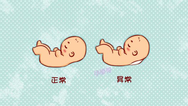 孕期NT检查和唐筛有什么区别？妇产科医生：主要看这一点
