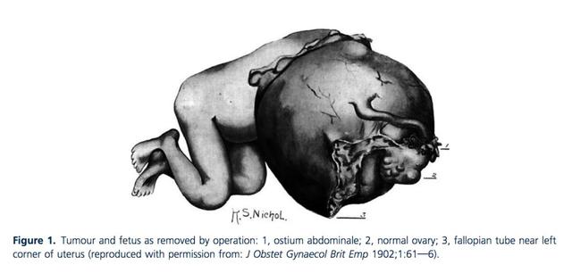 怀孕这事儿吧！得挑个好地方……