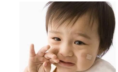 孩子嘴角干燥起屑、起泡，不要只会傻傻给孩子擦嘴了