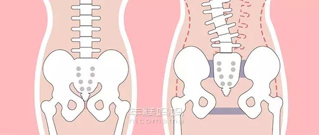 生娃后屁股大不大，反映了你的骨盆恢复情况