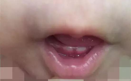 你家孩子怎么还没出牙，怎么这么瘦，怎么还不会走…………要你管！