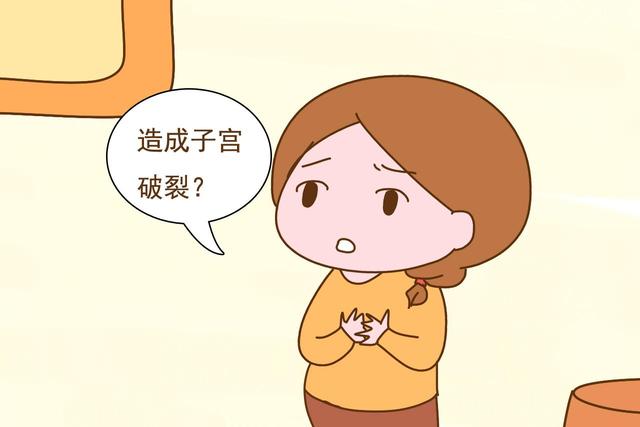 头胎剖二胎就一定不能顺吗？医生说，这几种情况是例外