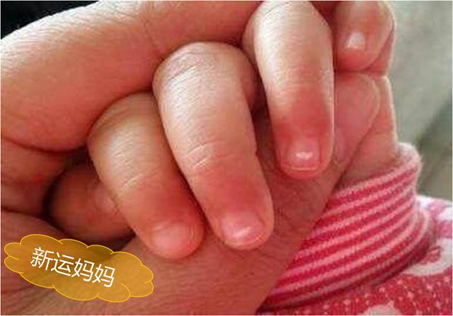 孩子出现7种表现，表明缺锌严重了，1碗粥补锌快