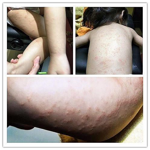 超常见的植物竟有毒！妈妈发文提醒：小心别碰