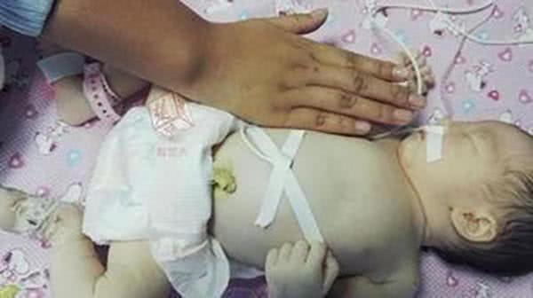 超预产期4周宝宝还没动静，安全起见剖腹产，生出宝宝后妈妈疼哭