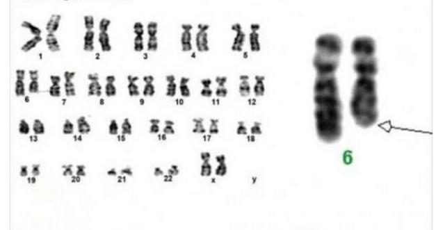 这个女孩天生具有超能力，被货车撞倒拖行30米后啥事没有！