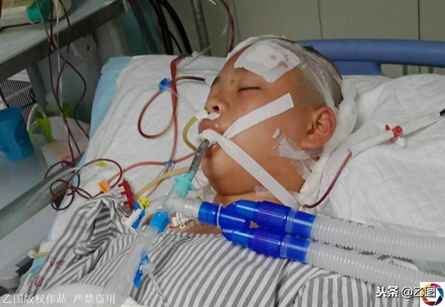 女孩喊头痛随后昏迷，手术后5个月未醒，妈妈每日守床前和她说话