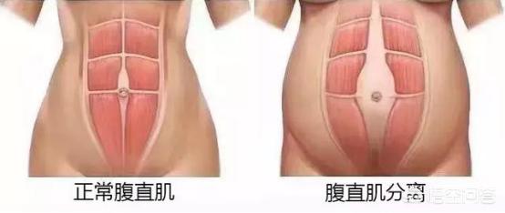 产后肚子赘肉下去了，肌肉还是松弛的，为什么？