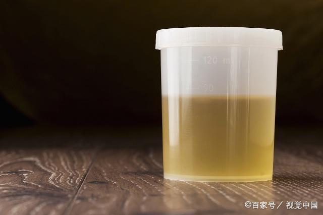 验孕时，显示一深一浅，是怀孕了吗？看完后你就明白了！