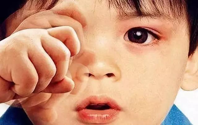 宝宝频繁揉眼睛，妈妈不可不重视的7大原因！