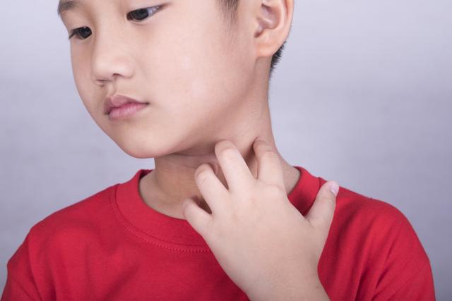 孩子湿疹乱用药，疹子变多了！儿科医师教我2招推手法，湿疹全消
