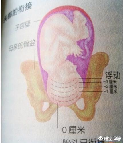 大夫是怎么检查胎儿入没入盆的？
