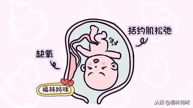 胎儿没出生排出胎便，一时“憋不住”造成大问题，胎便应该何时排