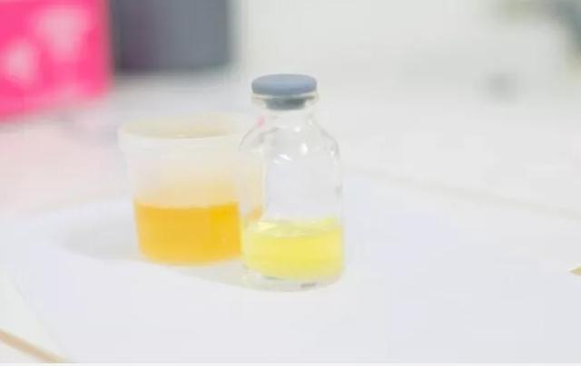 孕期担心上个厕所就把羊水排光了？教你用一张纸就能轻松辨别