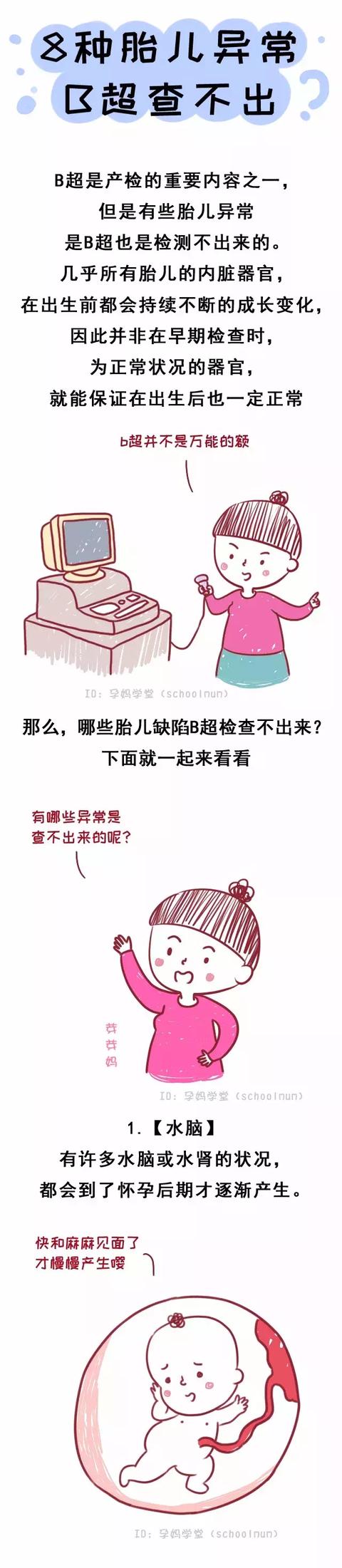 8种胎儿畸形，B超也查不出！