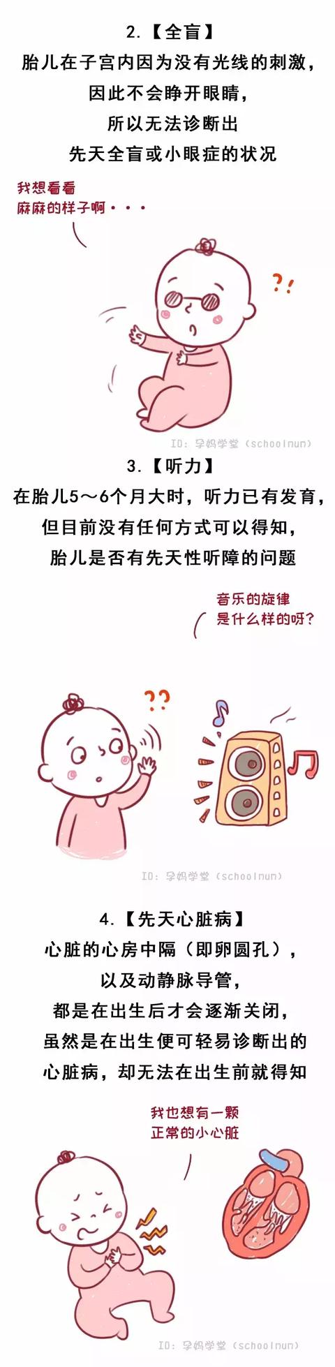 8种胎儿畸形，B超也查不出！