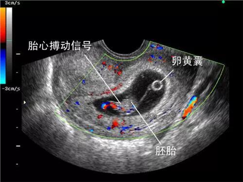 胎儿是否健康？手把手教你轻松学会看B超单