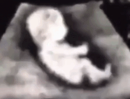 胎动是什么感觉？