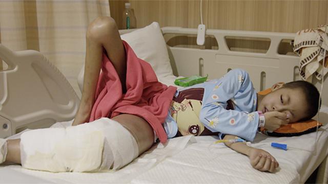 人间世2·烟花丨骨肿瘤VS孩子 百万分之三的概率