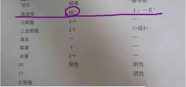 孕期出现这样的分泌物，小心早产