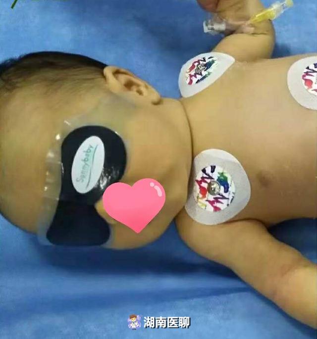 婴儿刚出生7天，经历两遍全身“大换血”：重度黄疸惹的祸！